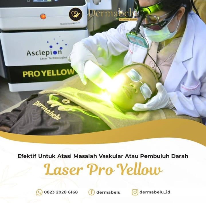 LASER PROYELLOW NEW BUATAN GERMAN